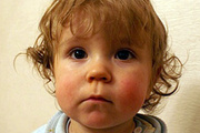 mo image
