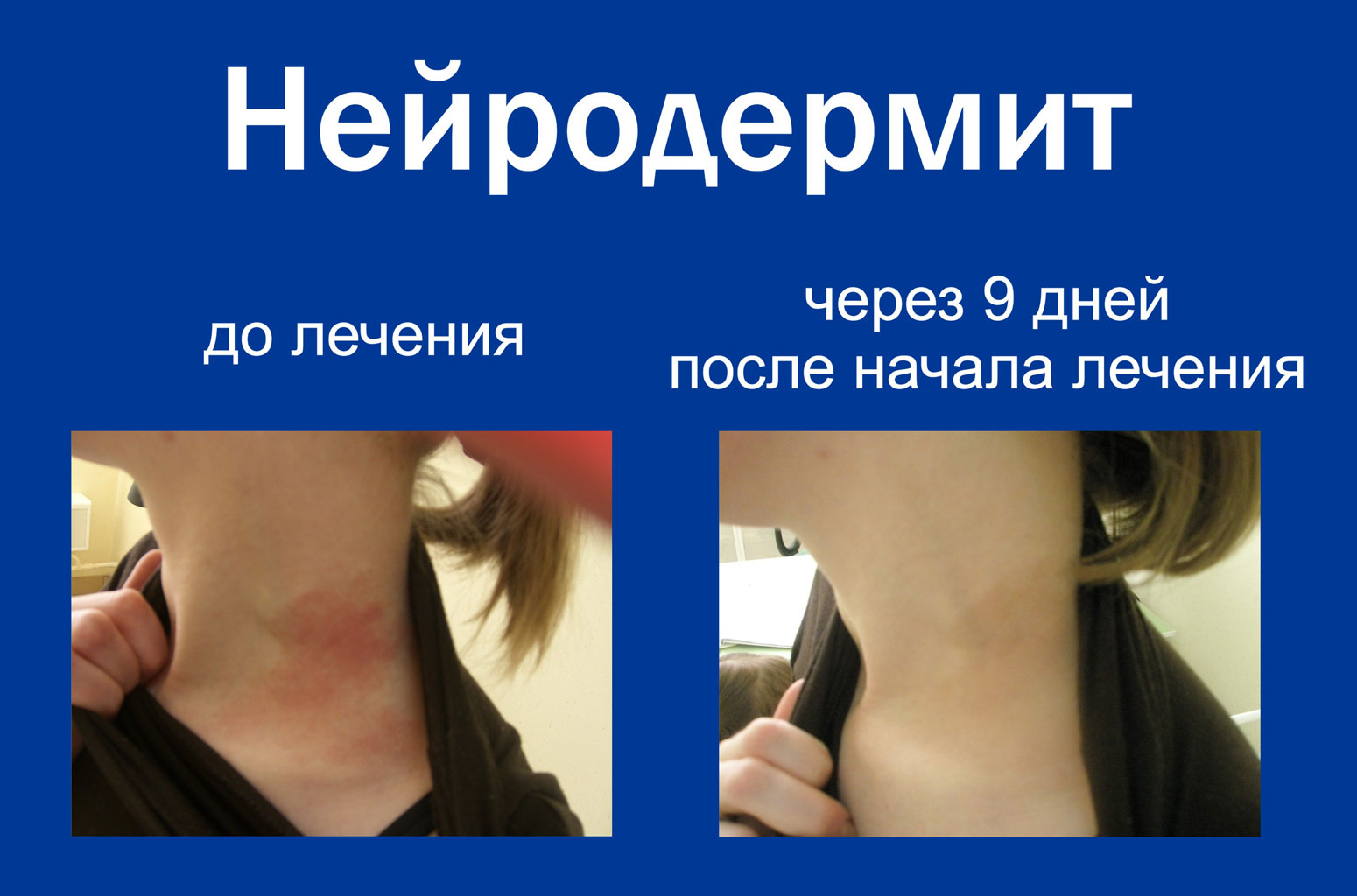 Клиники для лечения псориаза в Нижнем Новгороде